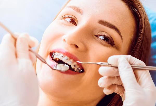 Paquete Completo de Brackets Metálicos + Limpieza + Regalo 