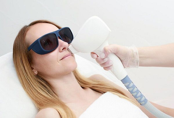 Laser Hair Removal LÃ¡ser Diodo Milesman El LÃ¡ser De Diodo Elimina El