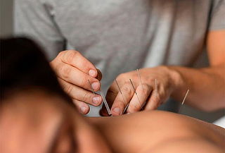 Acupuntura + Quiropraxia + Consulta 