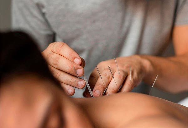Acupuntura + Quiropraxia + Consulta 