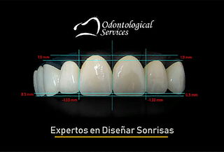 Pack Diseño de Sonrisa en Odontological Services