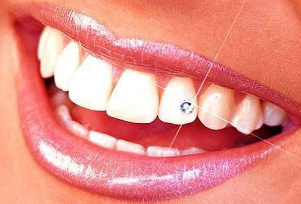  PIERCING DENTAL Brillante Dental en Armoniza Dent