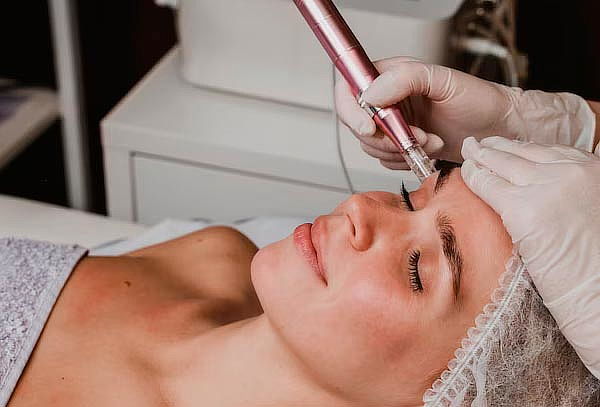 Limpieza Facial Profunda con Punta de Diamantes y más