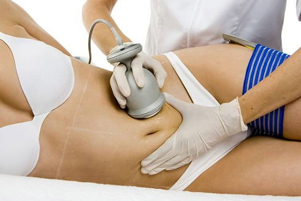 ¡LIPO SIN CIRUGÍA! + Hidrolipoclasia + Ultracavitador y Más