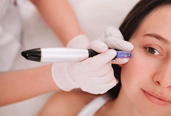 Rejuvenecimiento Facial  Dermapen + Plasma Rico en Plaquetas