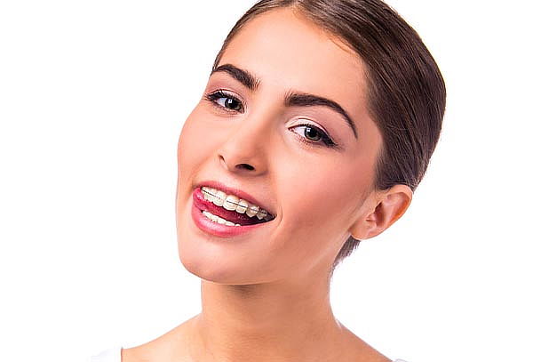 Brackets Metálicos + RX + Blanqueamiento