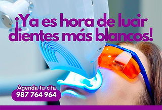 1 Sesión de Blanqueamiento Dental + Profilaxis 