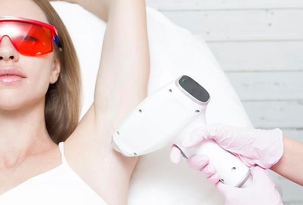 Depilación Láser Diodo en Axilas