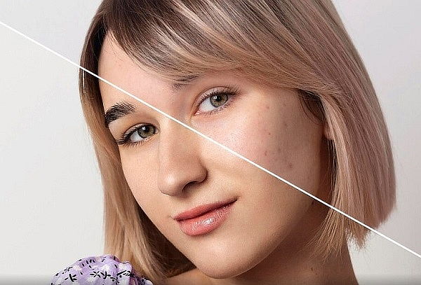 Rejuvenece con Exosomas, Esperma de Salmón y PDRN