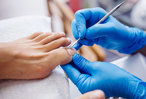 Podología Integral + 1 Sesión De Laser Antihongos