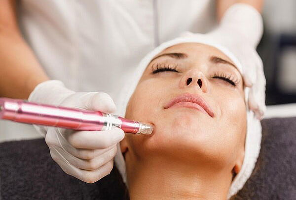 Tratamiento Facial con Dermapen con Ácido Hialuronico y Más
