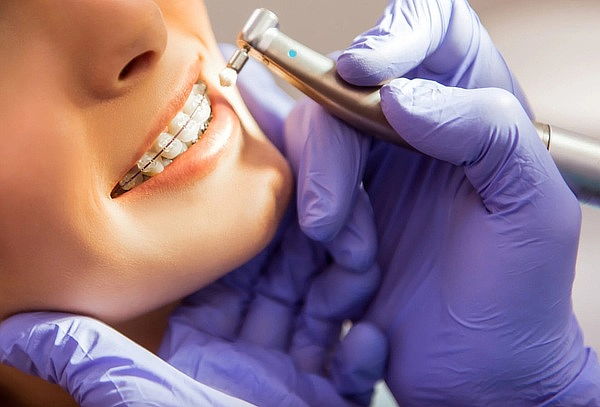 Limpieza Dental + 1 Resina o Sellante + Flúor + Consulta