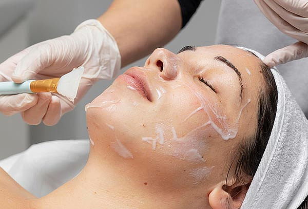 Limpieza Facial Profunda Opción: Peeling + Ozonoterapia
