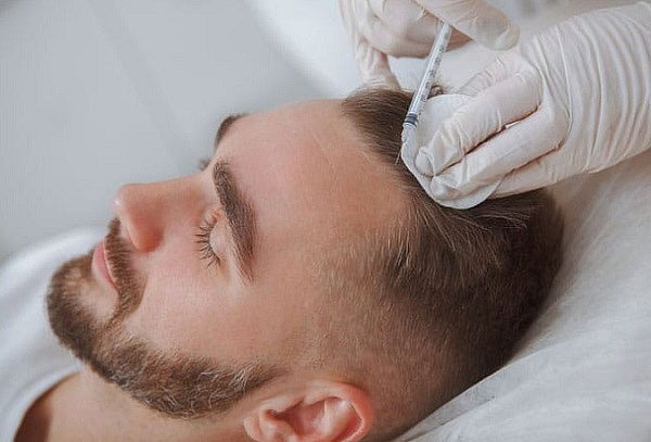 Plasma Capilar + Cocktail de Vitaminas + Minoxidil Y Más