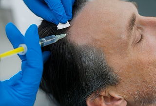Plasma Rico En Plaquetas Capilar + Cóctel De Minoxidil
