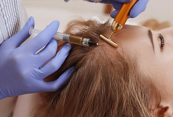 Plasma Rico En Plaquetas Capilar + Cóctel De Minoxidil