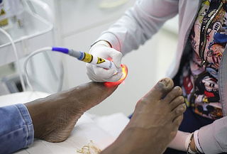 Pódología Laser 4 Sesiones 