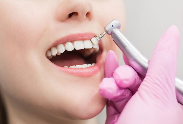 Consulta Odontológica + Profilaxis + Radiografía Periapical