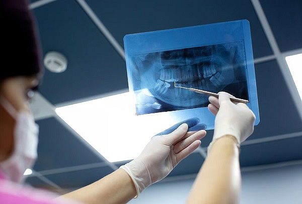 Evaluación Dental + Radiografía Digital y más...