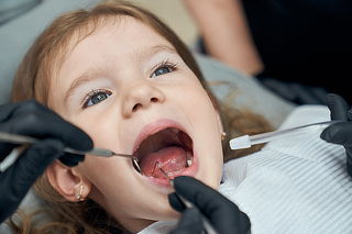 Limpieza Dental Infantil + Odontograma + Profilaxis + Flúor