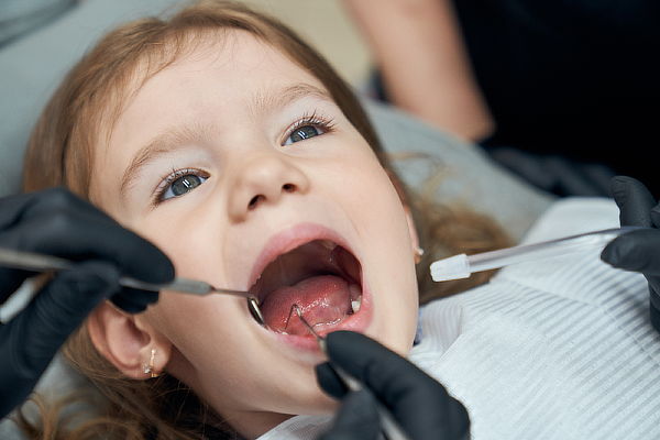 Limpieza Dental Infantil + Odontograma + Profilaxis + Flúor