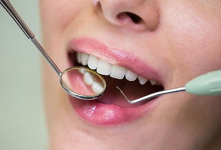 3 Resinas Simples + Profilaxis + Odontograma 