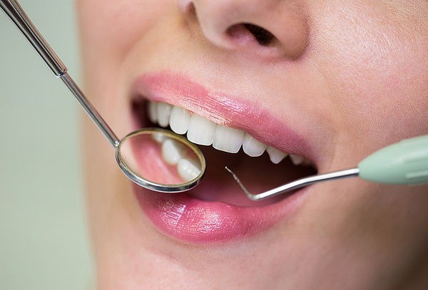 3 Resinas Simples + Profilaxis + Odontograma 