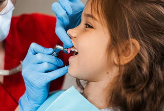 Profilaxis kids + Evaluación + Odontograma + Fisio Oral