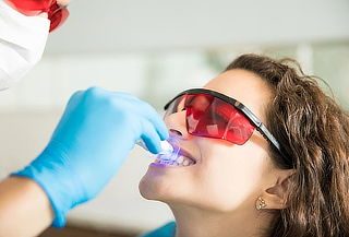 Blanqueamiento Dental En Consultorio y más