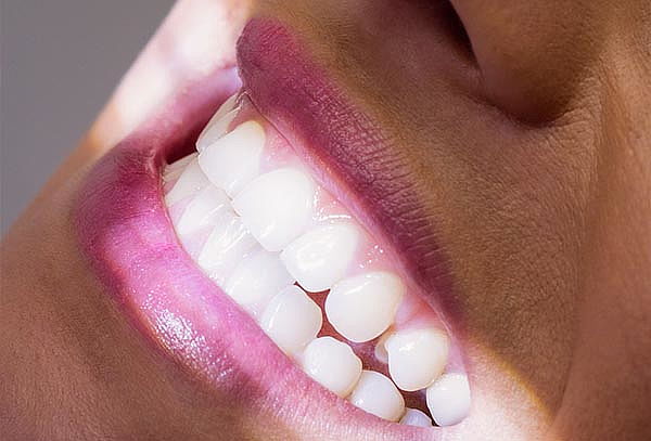 03 Secciones De Barniz Fluorado + Evaluación Y más