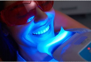 Sonrisa Radiante Limpieza dental + blanqueamiento dental LED