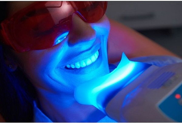 Sonrisa Radiante Limpieza dental + blanqueamiento dental LED