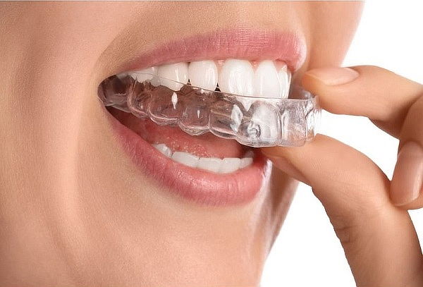 Sonríe y Descansa: Férula de Relajación + Profilaxis Dental