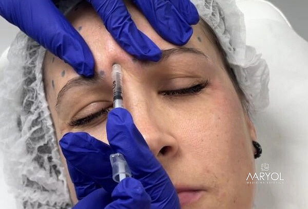 Rejuvenecimiento Facial + Toxina botulínica + Vitaminización