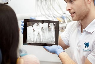  Radiografía Periapical + Odontograma + Curacion Simple