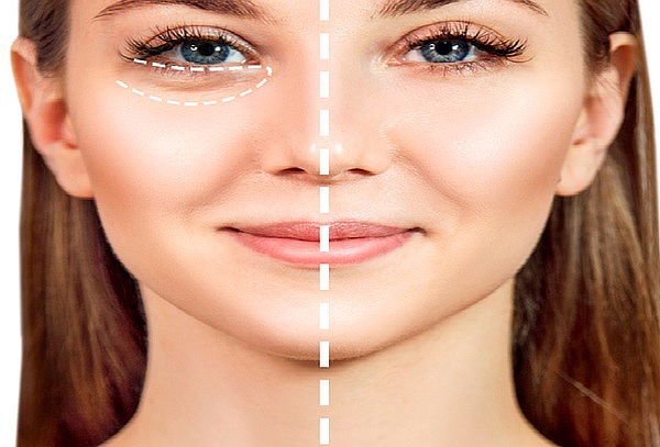 5 Sesiones: Reducción de Papada + Ojeras + Perfilado Facial