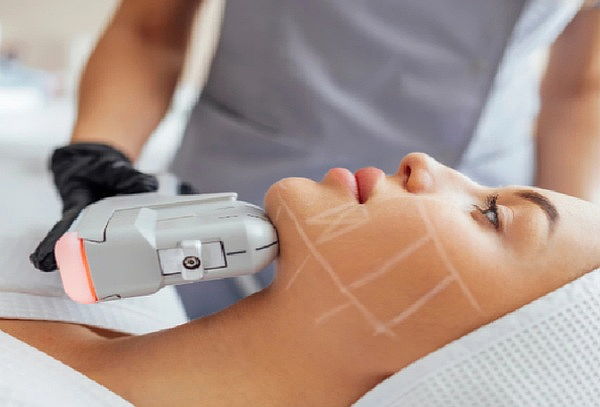 ¡Reducción de PAPADA con HIFU 7D! Define, Perfila y Tensa