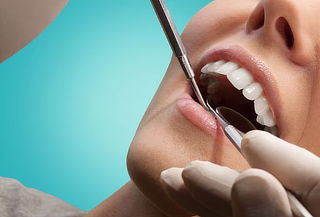 Profilaxis Dental + Evaluación Odontológica