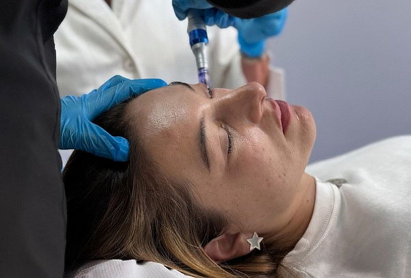 6 Tubos de PRP Rostro + Cuello + Escote + Facial + Dermapen