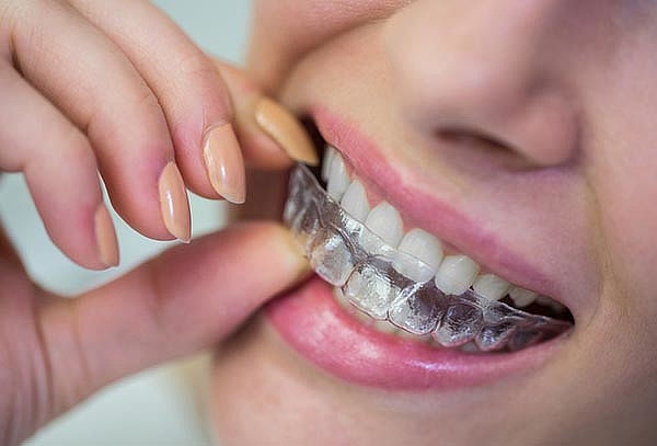 1 Férula de Relajación + Odontograma + Profilaxis 