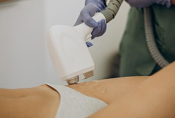 1 Sesión de IPL Depilación Femenina Zona V en Monas Spa