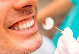 5 o 7 Curaciones + Fluorización + Profilaxis y más