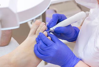 Podologia Clinica + Exfoliacion + Alta frecuencia + Laser 