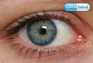 Operación de Carnosidad Ocular + Materiales + Consultas 51%