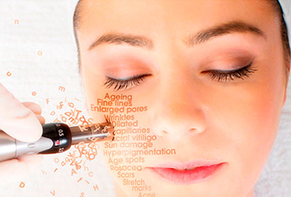 Was and limpieza facial laser think Limpieza facial laser consider