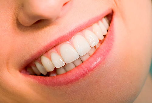 ¡Dientes Sanos! 3 ó 5 Curaciones y Más en Miraflores