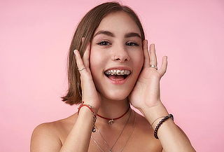 Sonrisa Perfecta con Brackets + Blanqueamiento y Más